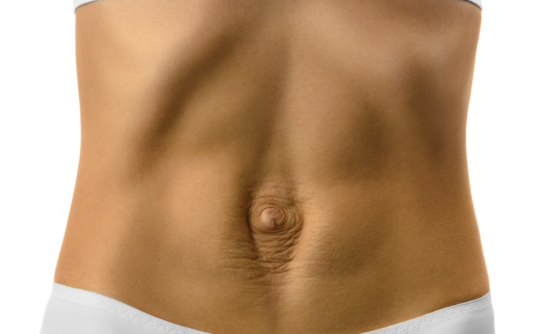 Διάσταση Λευκής Γραμμής