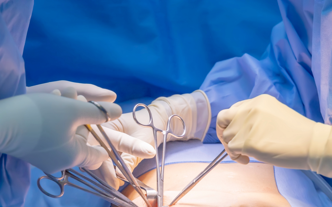 Αποκατάσταση Βουβωνοκήλης – Ομφαλοκήλης – Κοιλιοκήλης