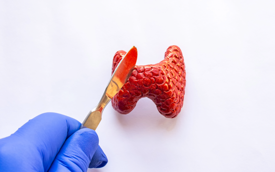 Θυρεοειδεκτομή